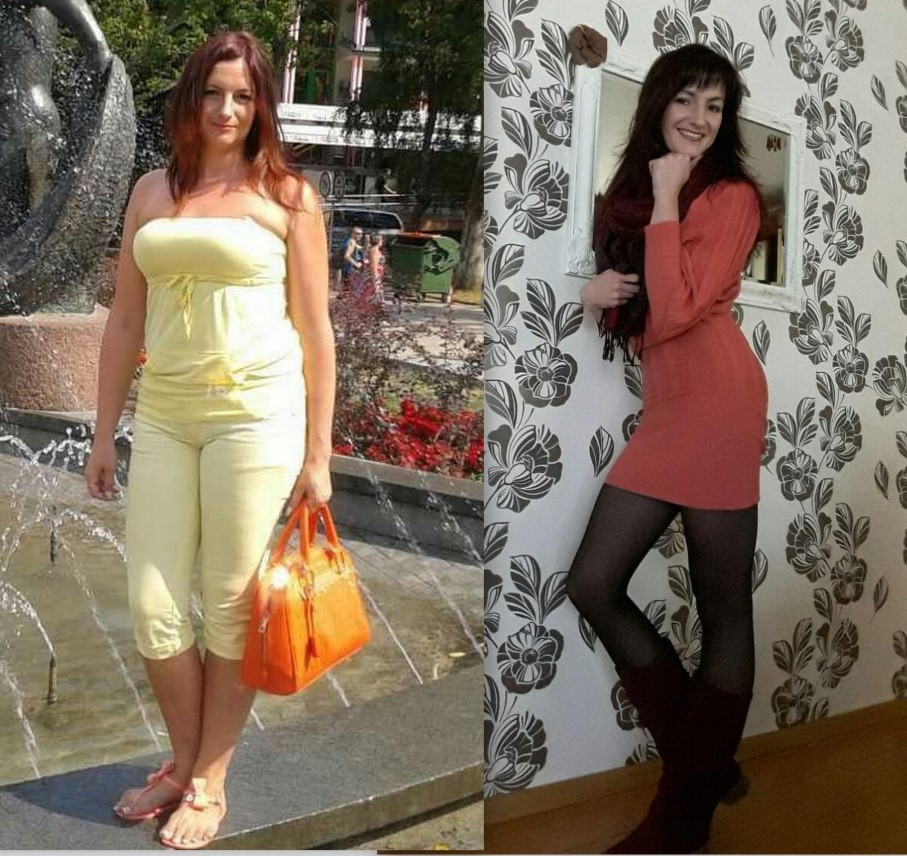 before_after_photo